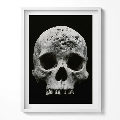 Obraz v rámu Kostra lidské lebky